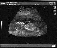 Hola ! Soy Luc&iacute;a, soy muy peque&ntilde;a todav&iacute;a